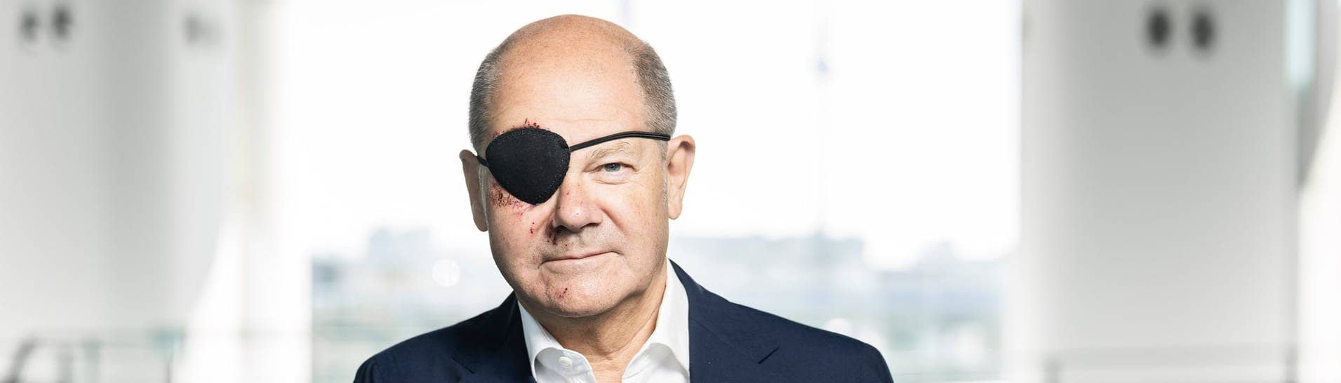 Bundeskanzler Olaf Scholz (SPD) mit Augenklappe, die er aufgrund einer Sportverletzung trägt.