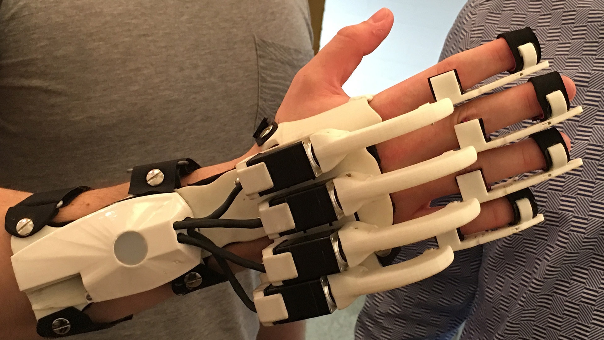 Foto: SWR Fingerttherapiegerät (Foto: SWR)