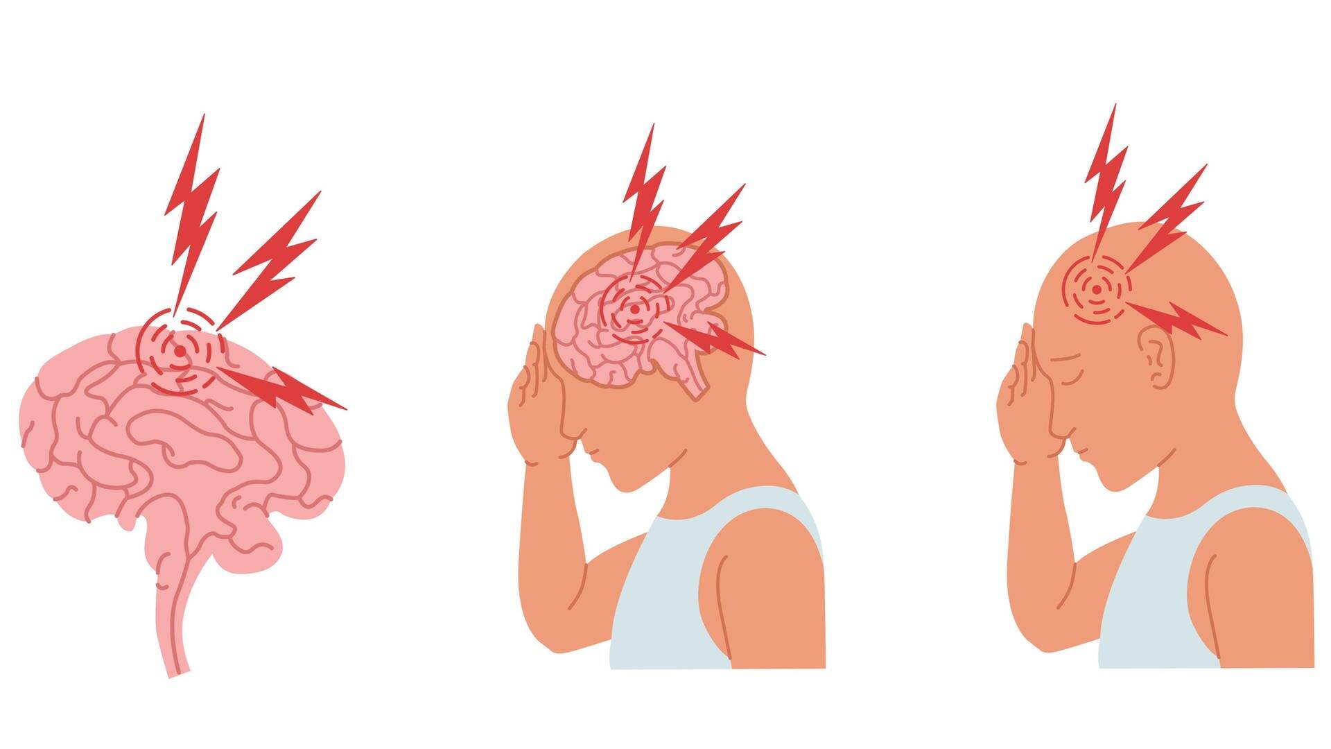 Drei Pictogramme von entstehenden Kopfschmerzen im Gehirn. (Foto: picture-alliance / Reportdienste, picture alliance / Zoonar | Vladyslav Severyn)