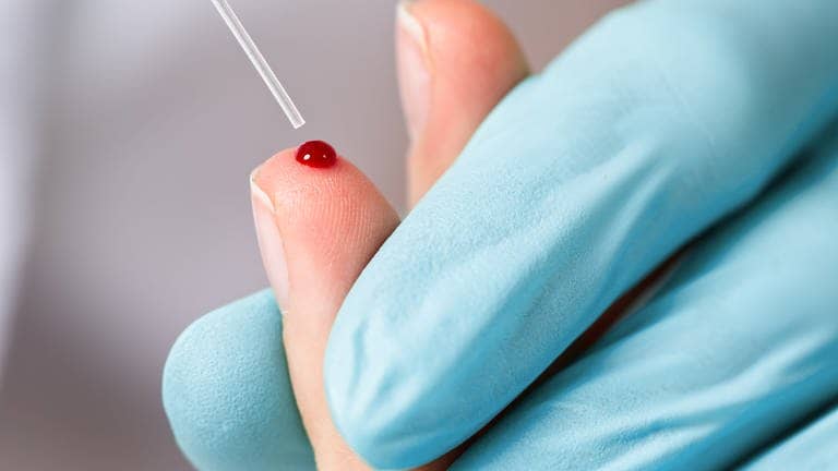 Medizinisches Personal nimmt einen Tropfen Blut am Finger ab (Foto: IMAGO, Pond5 Images)