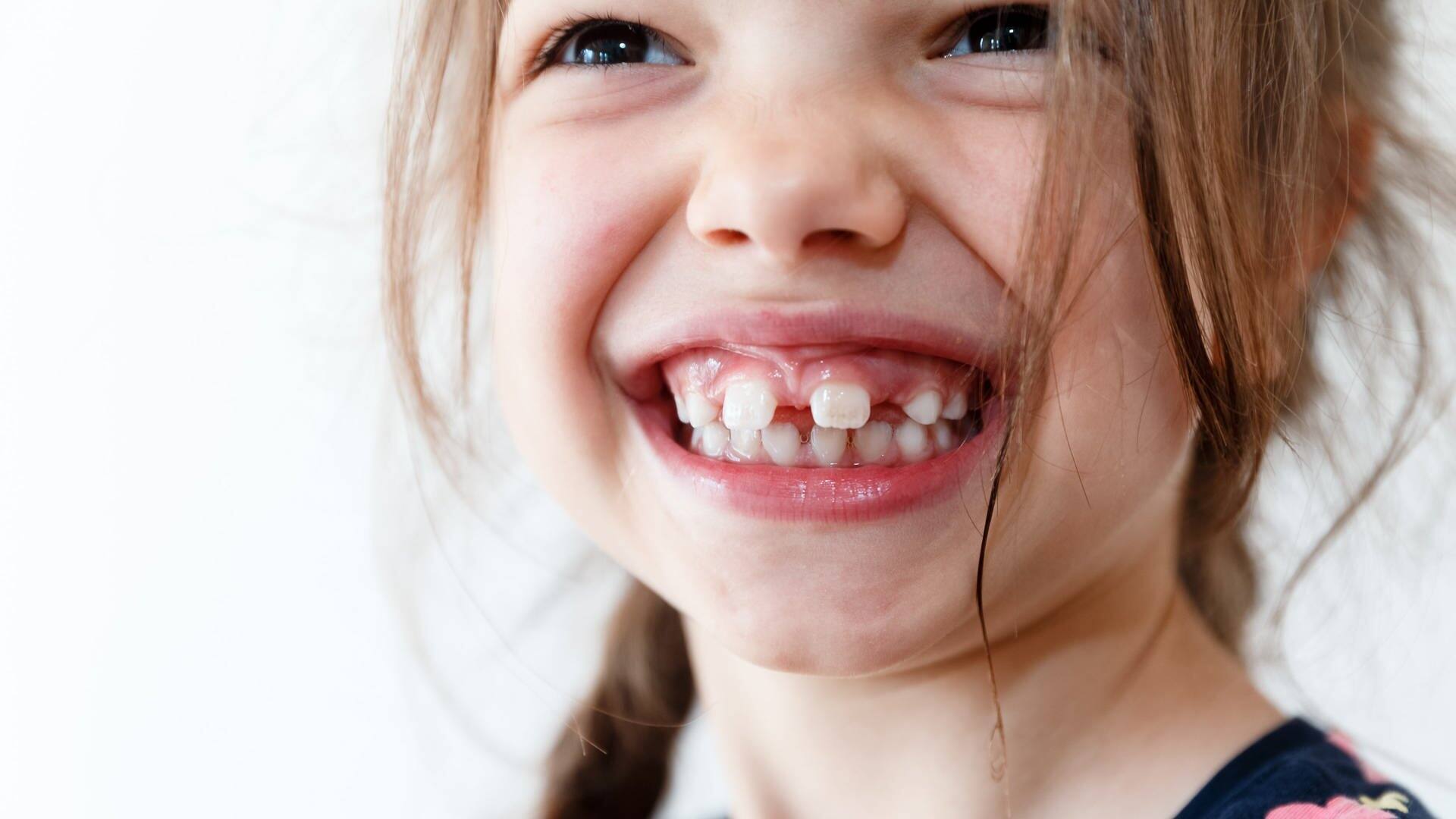 Kind mit wenigen Zähnen im Mund (Foto: picture-alliance / Reportdienste, picture alliance / dpa Themendienst | Markus Scholz)