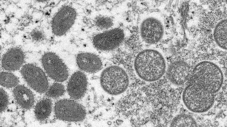 Diese elektronenmikroskopische Aufnahme aus dem Jahr 2003, die von den Centers for Disease Control and Prevention zur Verfügung gestellt wurde, zeigt reife, ovale Affenpockenviren (l) und kugelförmige unreife Virionen (r), die aus einer menschlichen Hautprobe im Zusammenhang mit dem Präriehundeausbruch von 2003 stammt.  (Foto: dpa Bildfunk, picture alliance/dpa/Russell Regner/CDC/AP | Cynthia S. Goldsmith)