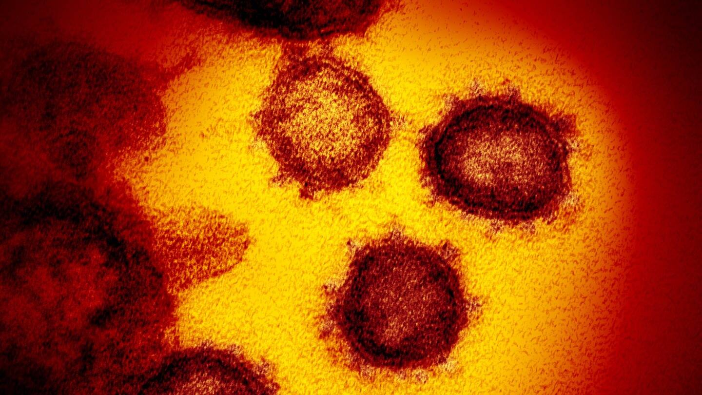 Die vom National Institute of Allergy and Infectious Diseases zur Verfügung gestellte Elektronenmikroskopaufnahme zeigt das Coronavirus SARS-CoV-2. (Foto: dpa Bildfunk, picture alliance/dpa/National Institute of Allergy and Infectious Diseases | Niaid-Rml)