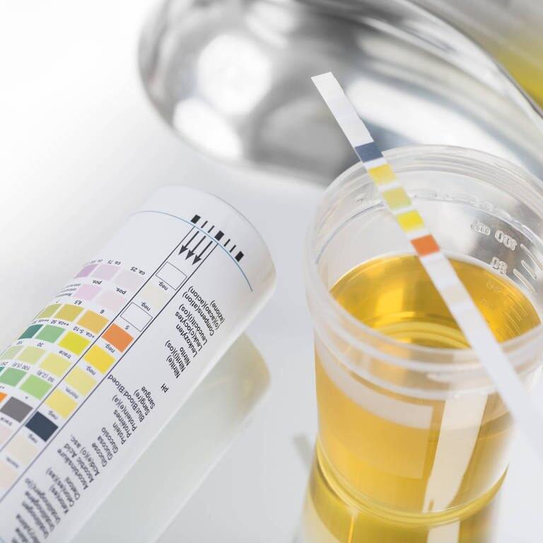 Urin-Schnelltest: Ein Becher mit Urin, daneben liegt ein farbiger Teststreifen  (Foto: IMAGO, IMAGO / Westend61)