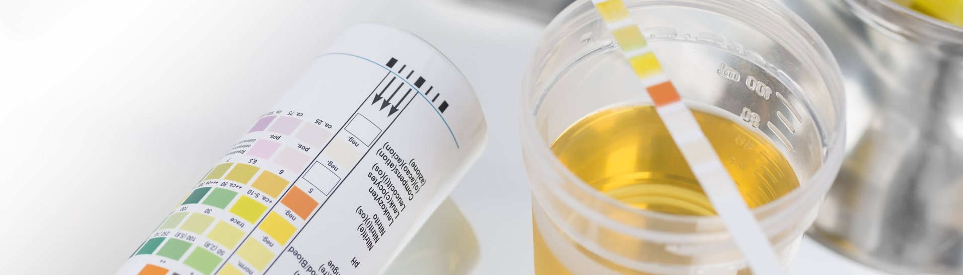 Urin-Schnelltest: Ein Becher mit Urin, daneben liegt ein farbiger Teststreifen  (Foto: IMAGO, IMAGO / Westend61)