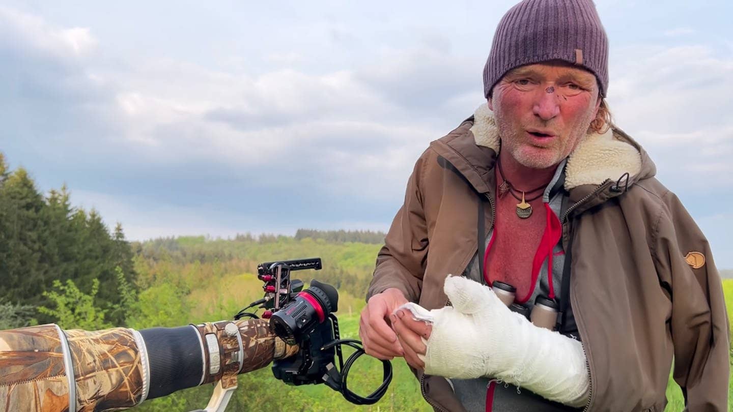 Tierfilmer Andreas Kieling steht an seiner Kamera und hat Verletzungen von der Bären-Attacke an Hand und Kopf. (Foto: SWR, screenshot aus Privatvideo Facebook Anderas Kieling)