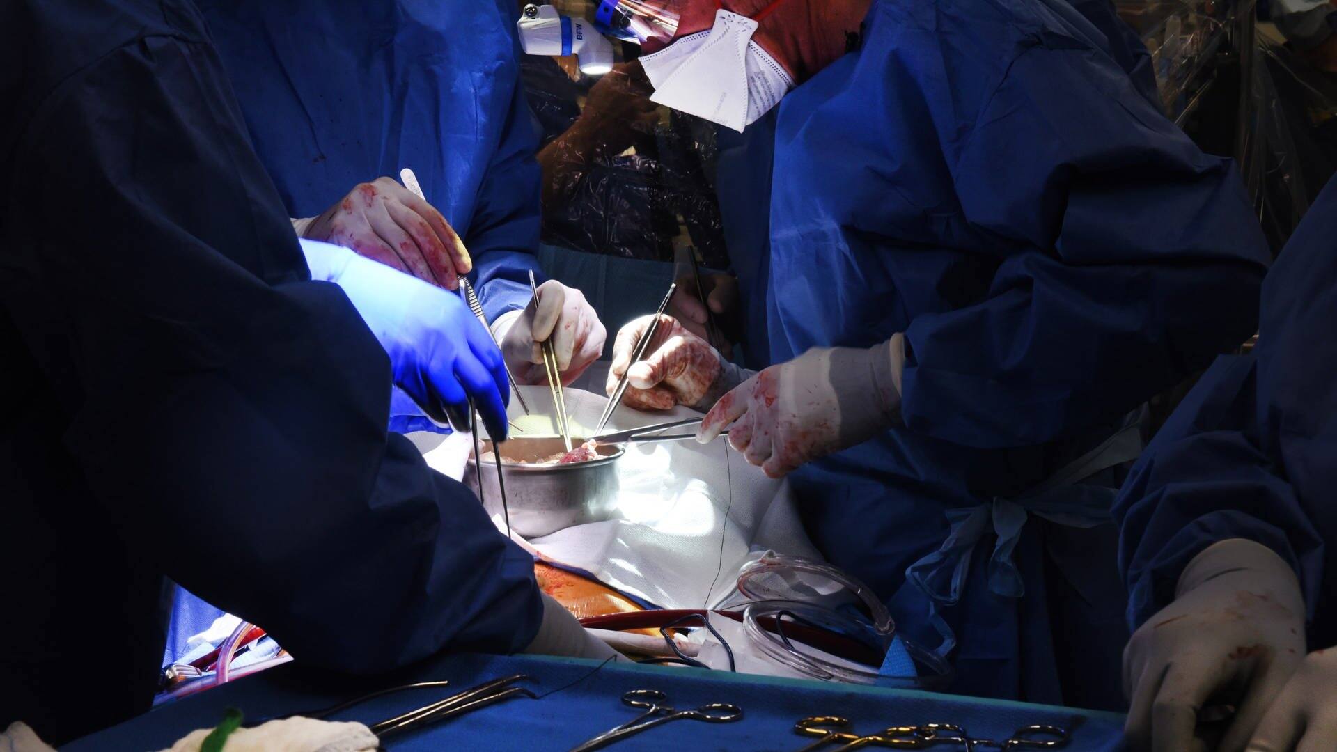 Ärzte operieren an einem Schweineherz das in einen menschlichen Patienten eingesetzt wird. (Foto: dpa Bildfunk, picture alliance/dpa/University of Maryland School of Medicine | Tom Jemski)