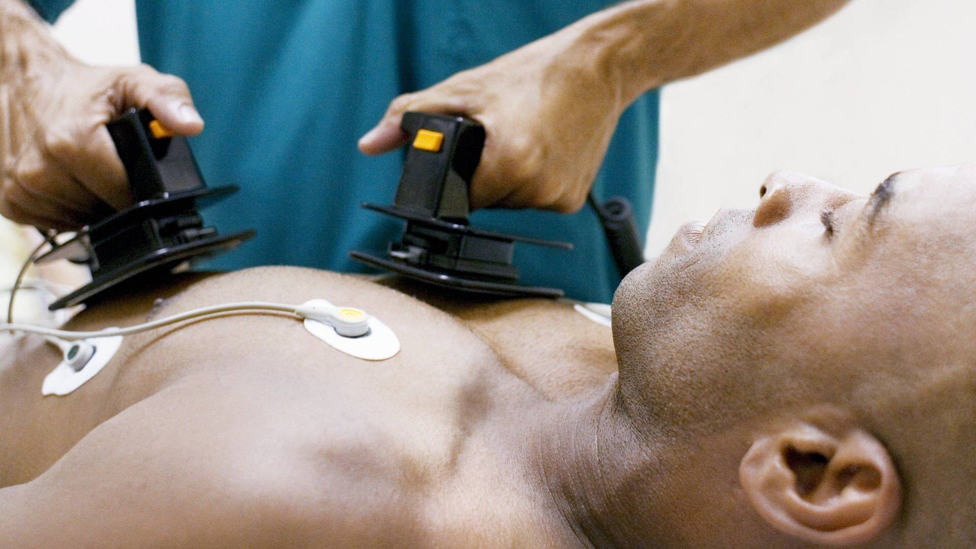 Ein bewusstloser Mann liegt, während ein Mediziner ihm einen Defibrillator auf die Brust hält (Foto: IMAGO, imago/Science Photo Library)