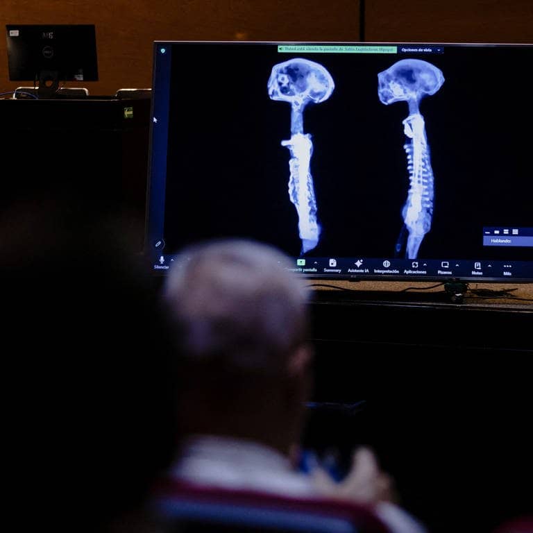 Zwei der angeblichen Röntgenfotos toter Aliens, die der Journalist José Jaime Maussan mexikanischen Abgeordneten präsentiert hat. (Foto: Reuters)