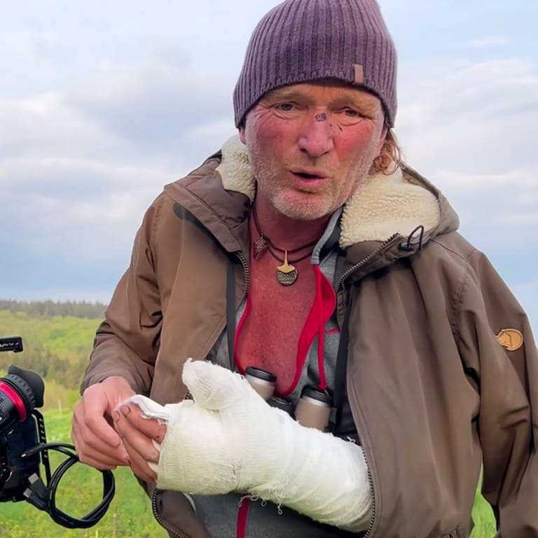 Tierfilmer Andreas Kieling steht an seiner Kamera und hat Verletzungen von der Bären-Attacke an Hand und Kopf.