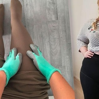 Frauen mit Lipödemen