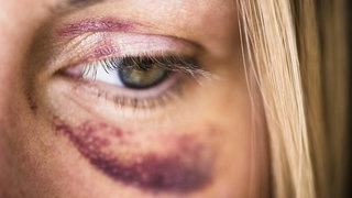 Gewalt gegen Frauen