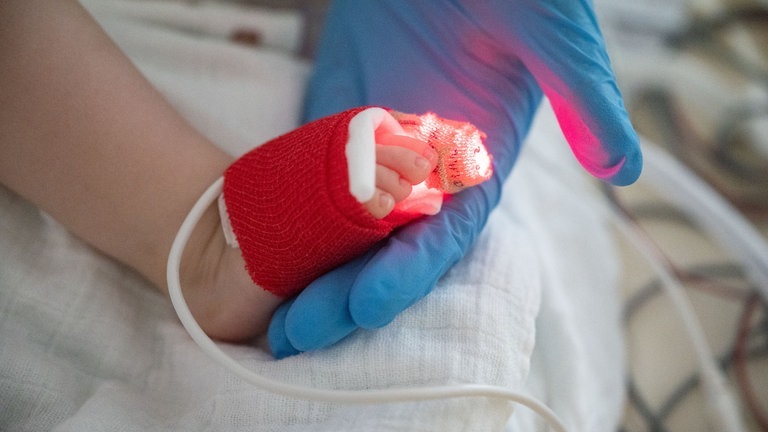 Ein Baby mit RS-Virus-Infektion wird im Krankenhaus behandelt (Foto: dpa Bildfunk, picture alliance/dpa | Marijan Murat)