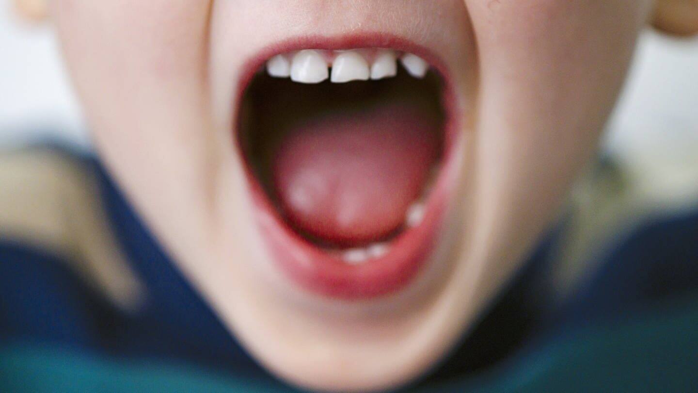 Ein Junge schreit (Foto: picture-alliance / Reportdienste, Thomas Trutschel;)