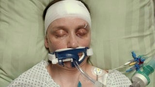 Eine verunglückte Frau ist mit Bandagen und Schläuchen im Mund im Krankenhausbett zu sehen. Szenenbild Polizeiruf 110 „Widerfahrnis“ aus Magdeburg. (Foto: © MDR/filmpool fiction/Stefan Erhard) Eine verunglückte Frau ist mit Bandagen und Schläuchen im Mund im Krankenhausbett zu sehen. Szenenbild Polizeiruf 110 „Widerfahrnis“ aus Magdeburg.