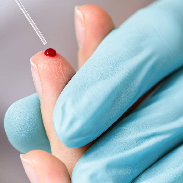Medizinisches Personal nimmt einen Tropfen Blut am Finger ab (Foto: IMAGO, Pond5 Images)