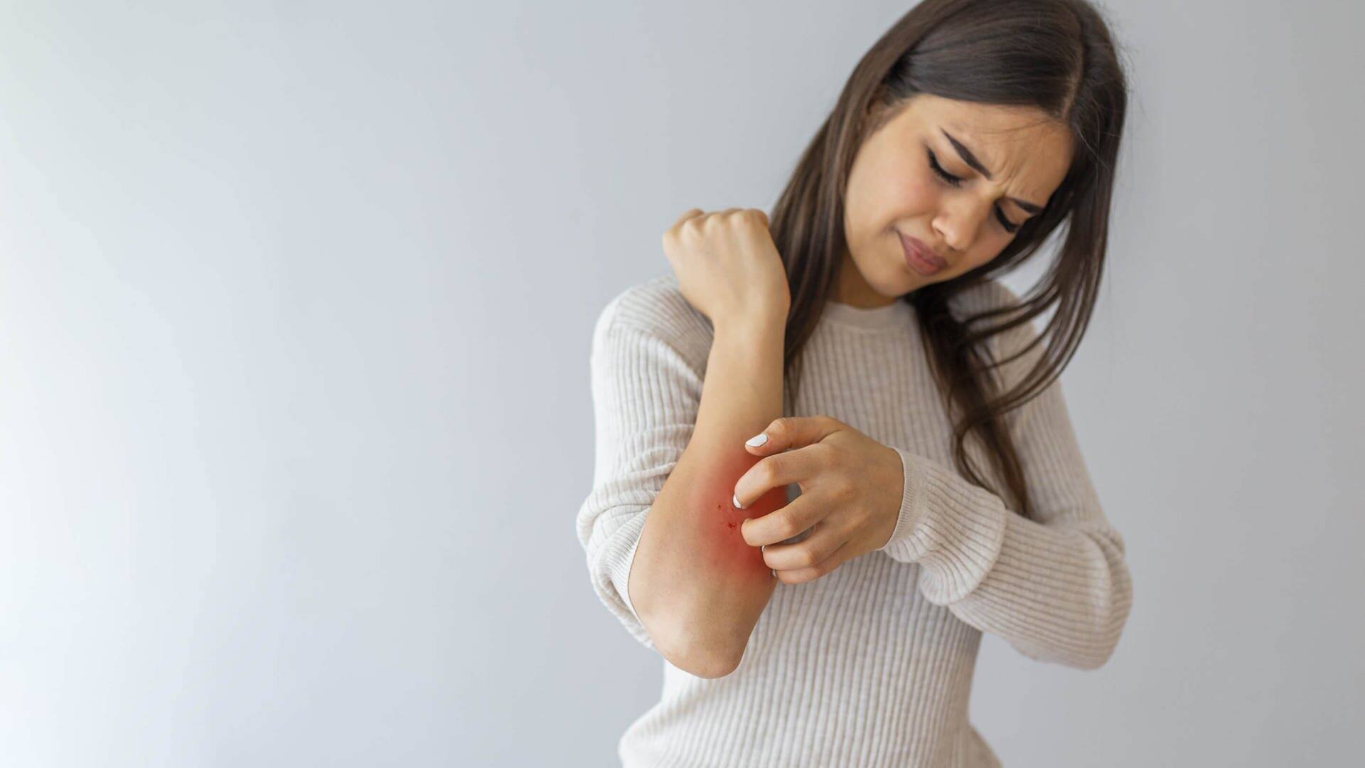 Junge Frau kratzt an ihrem Arm (Foto: Adobe Stock/Dragana Gordic)