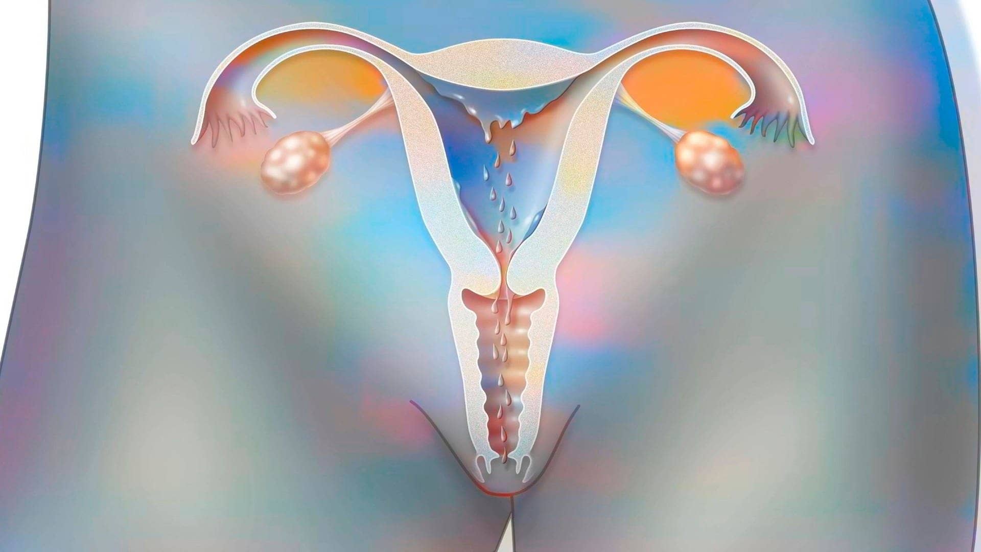 Modell einer Gebärmutter während der Periode.
